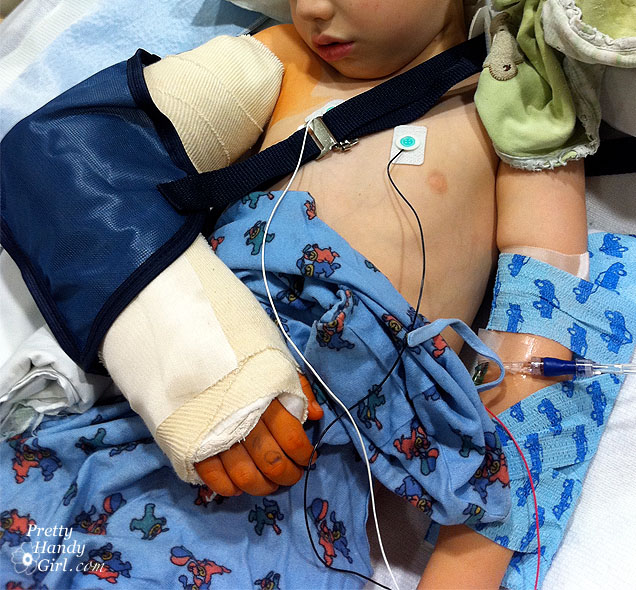 broken_arm